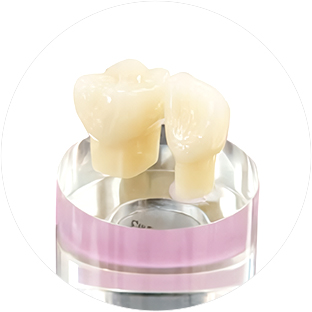 白い被せ物 | ジルコニアセラミック