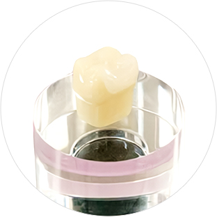 白いつめ物 | e-max（セラミック）